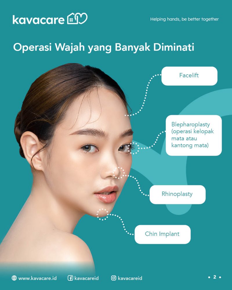 Operasi Wajah, Operasi Plastik, Operasi Plastik di Korea Selatan, Facial Surgery Infographics – Kavacare