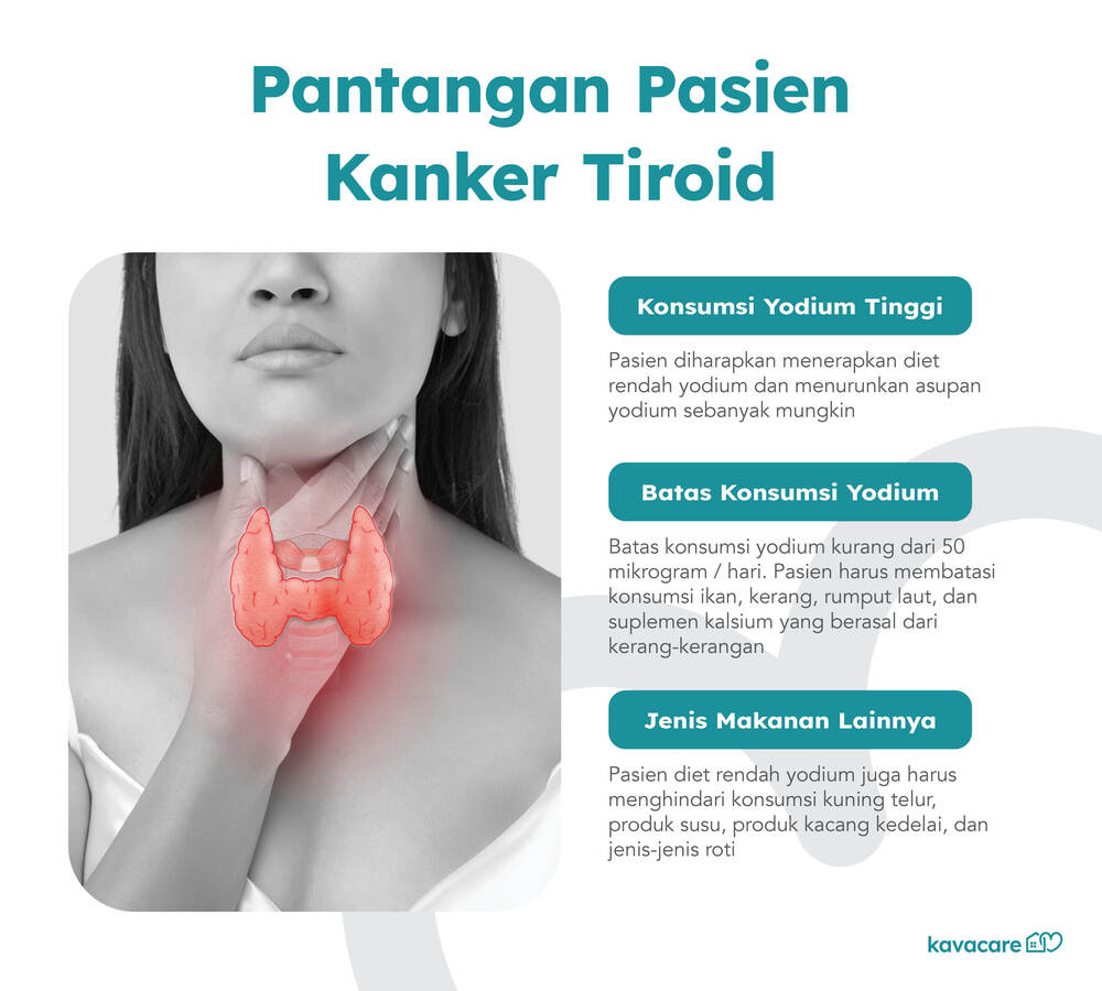 Kanker Tiroid Gejala Dan Penanganan Kavacare