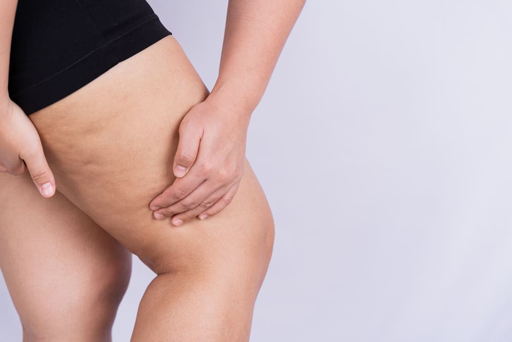 Prosedur Thigh Lift: Risiko dan Rekomendasi Rumah Sakit [2024]